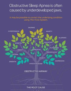 Sleep Disordered Breathing